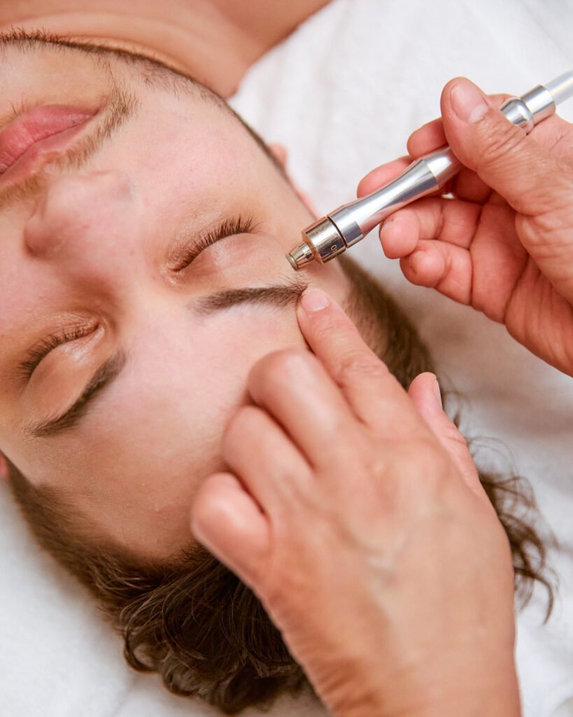 Microdermabrasion